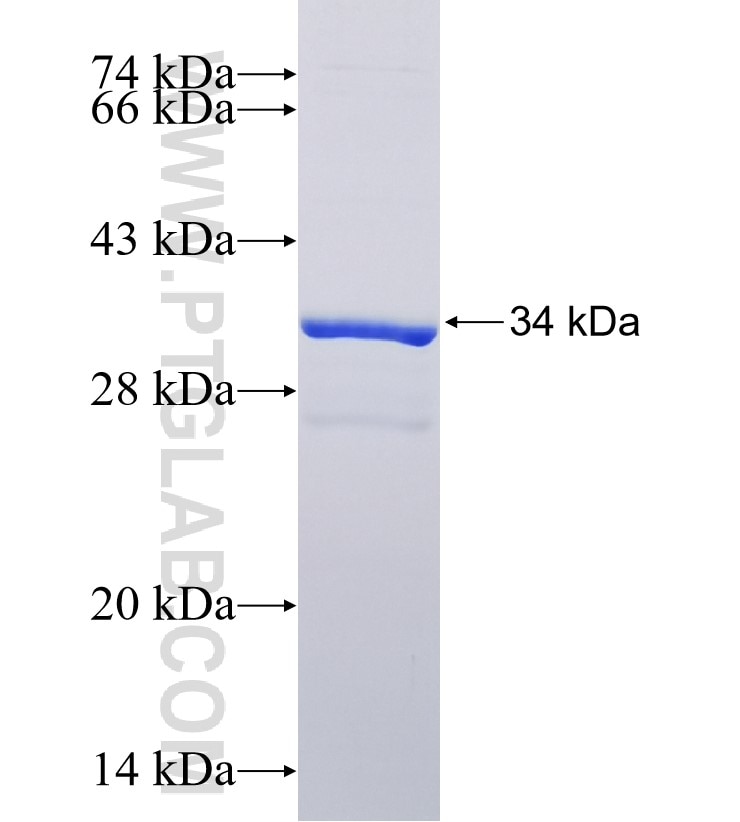 2019-nCOV envelope protein fusion protein Ag30690 SDS-PAGE