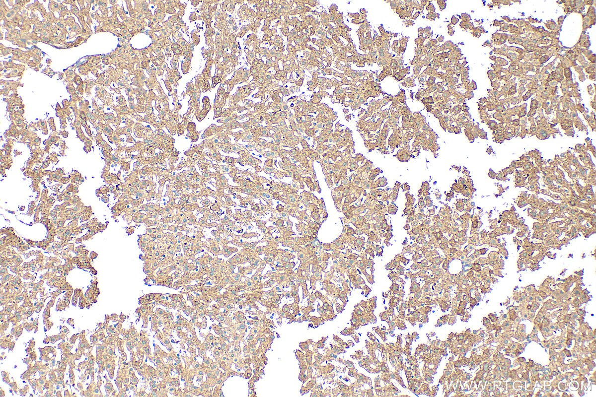 ferritin heavy chain antibody (33233-1-AP) | Proteintech
