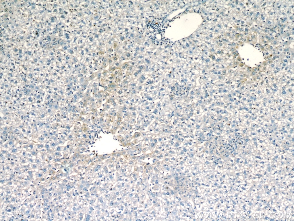 Immunohistochemistry (IHC) staining of mouse liver tissue using fetuin-B Polyclonal antibody (18052-1-AP)