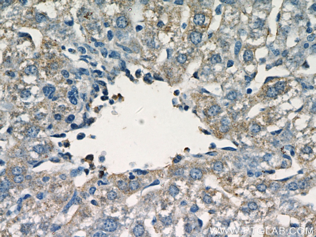 Immunohistochemistry (IHC) staining of mouse liver tissue using fetuin-B Polyclonal antibody (18052-1-AP)