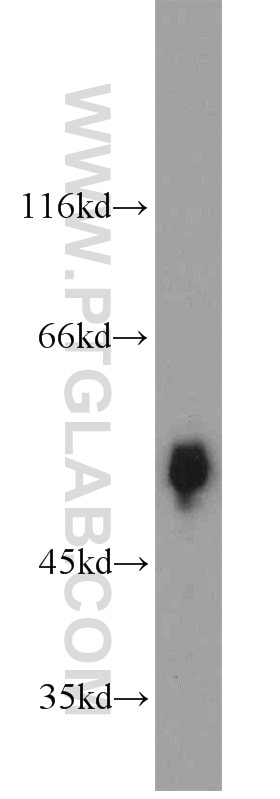 Western Blot (WB) analysis of human plasma using fetuin-B Polyclonal antibody (18052-1-AP)