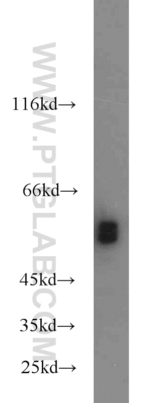 Western Blot (WB) analysis of human plasma using fetuin-B Polyclonal antibody (18052-1-AP)