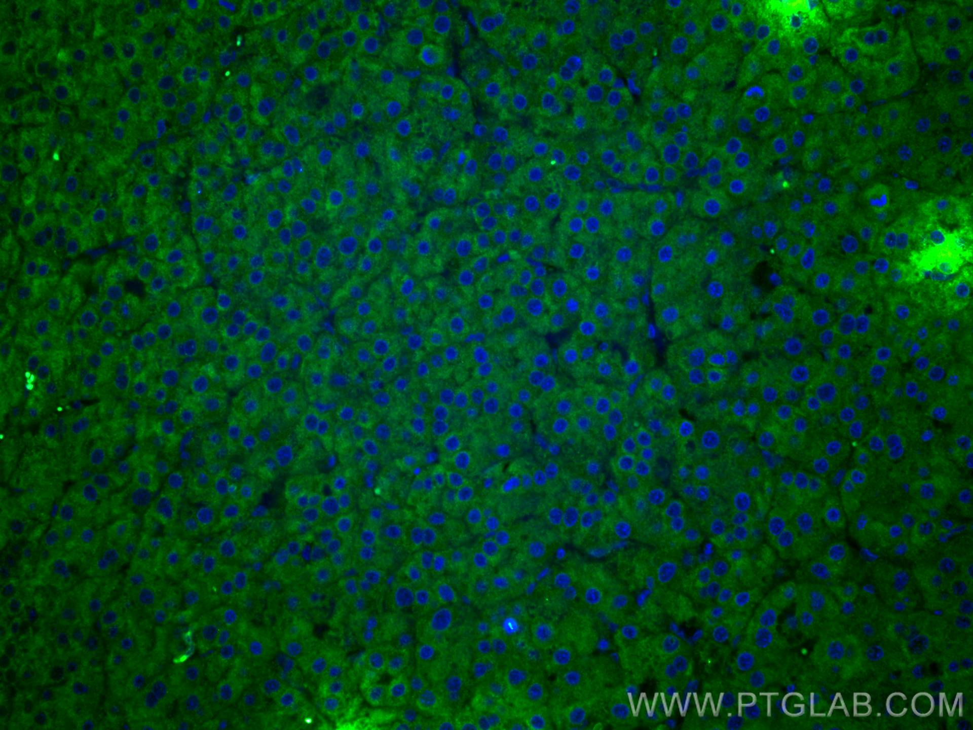 Immunofluorescence (IF) / fluorescent staining of human liver cancer tissue using fetuin-B Monoclonal antibody (67002-1-Ig)