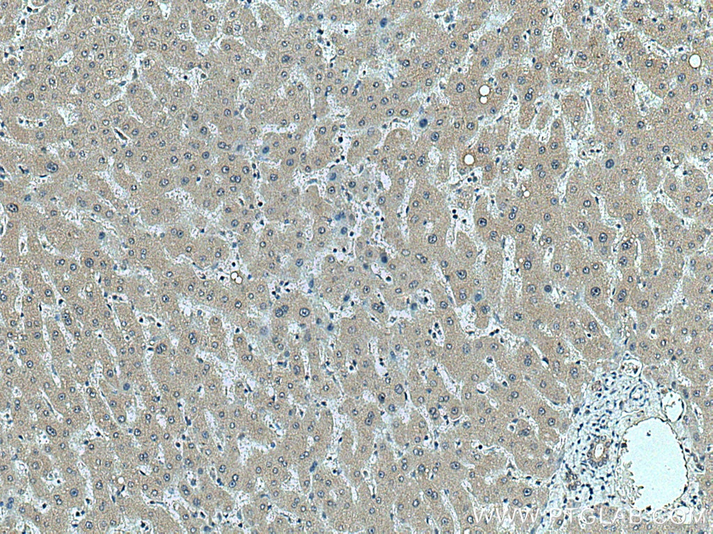 Immunohistochemistry (IHC) staining of human liver tissue using fetuin-B Monoclonal antibody (67002-1-Ig)