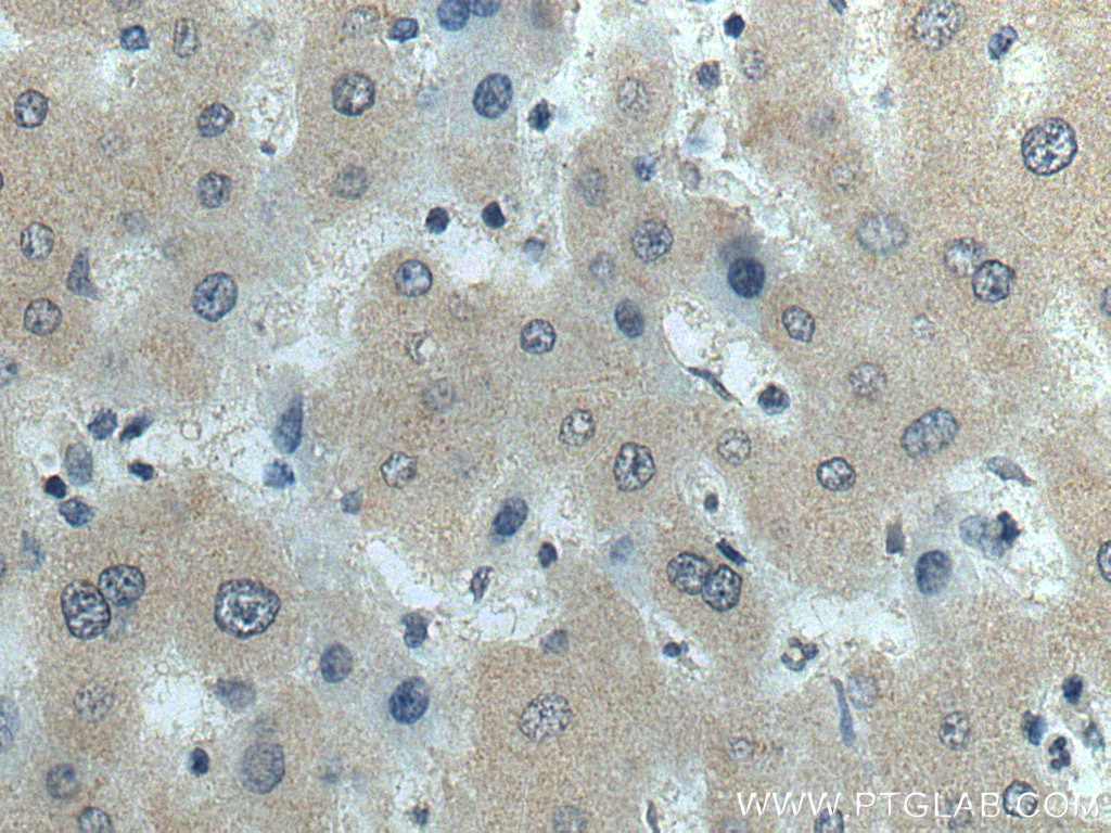 Immunohistochemistry (IHC) staining of human liver tissue using fetuin-B Monoclonal antibody (67002-1-Ig)