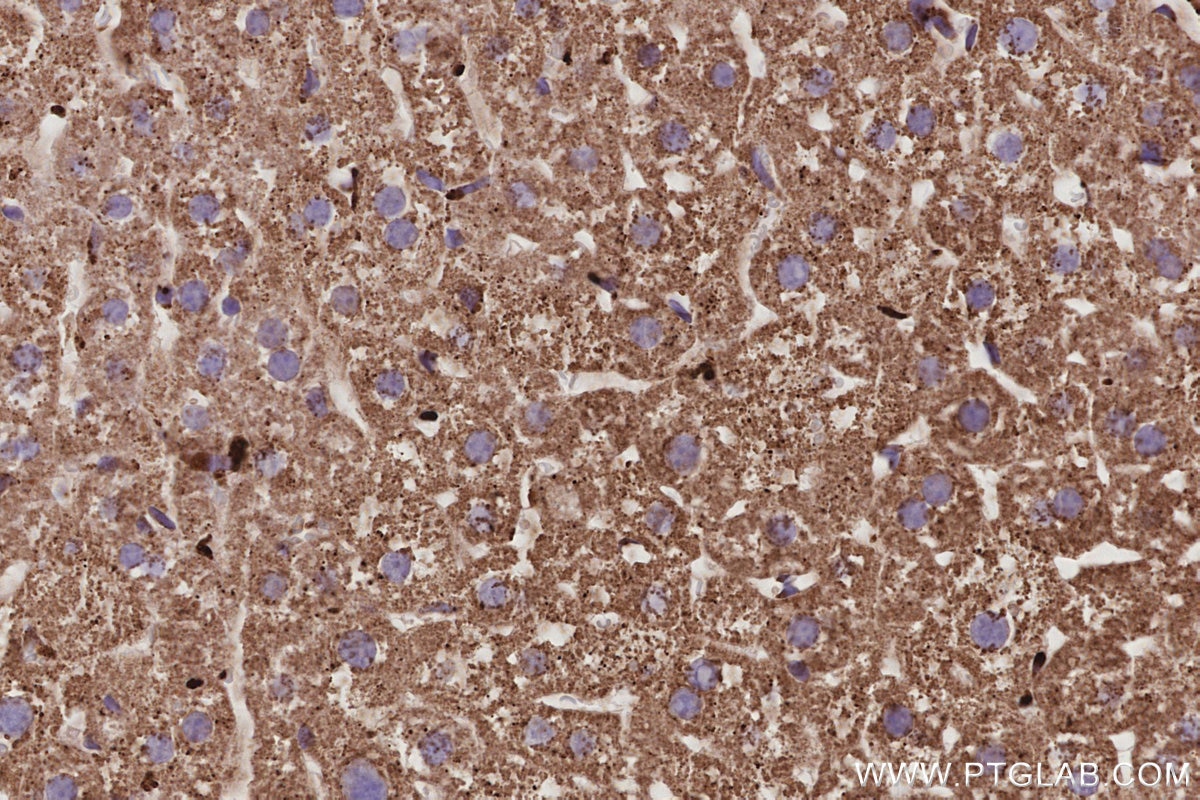 Immunohistochemistry (IHC) staining of mouse liver tissue using fetuin-B Monoclonal antibody (67002-1-Ig)