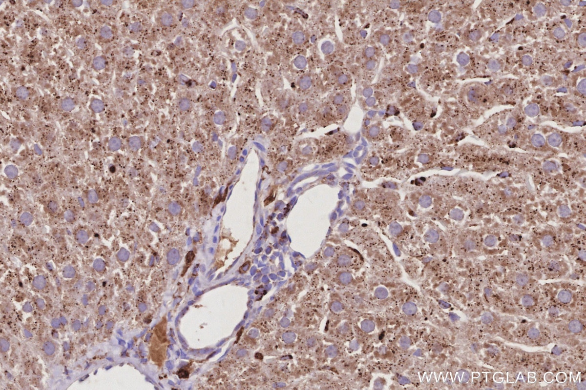 Immunohistochemistry (IHC) staining of rat liver tissue using fetuin-B Monoclonal antibody (67002-1-Ig)