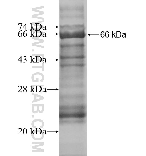 fetuin-B fusion protein Ag12562 SDS-PAGE
