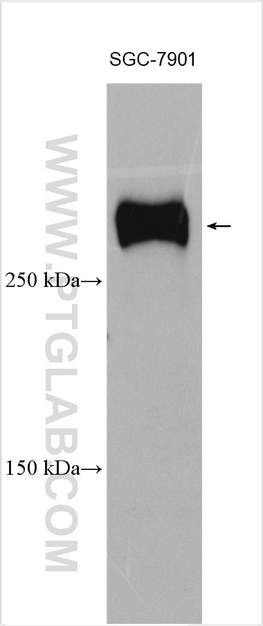 WB analysis of SGC-7901 using 28492-1-AP