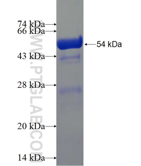 gag-pro-pol fusion protein Ag1374 SDS-PAGE