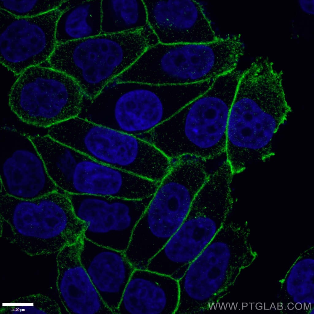 Immunofluorescence (IF) / fluorescent staining of HeLa cells using Gamma Catenin Polyclonal antibody (27872-1-AP)