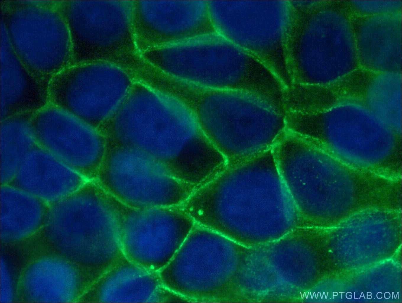 Immunofluorescence (IF) / fluorescent staining of MCF-7 cells using Gamma Catenin Polyclonal antibody (27872-1-AP)