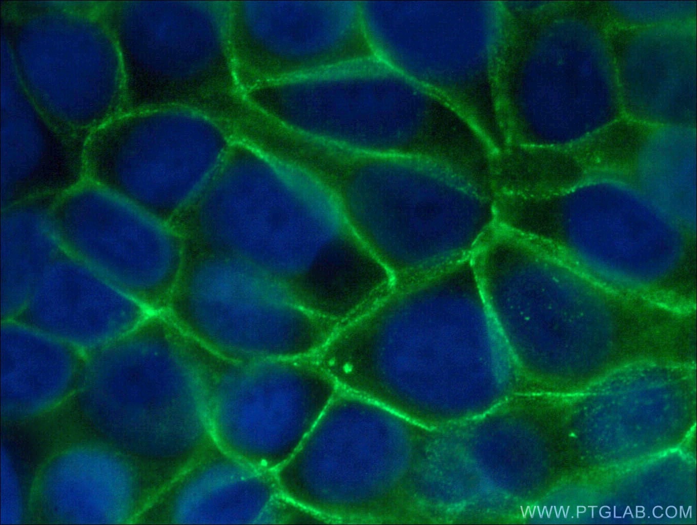 IF Staining of MCF-7 using 27872-1-AP