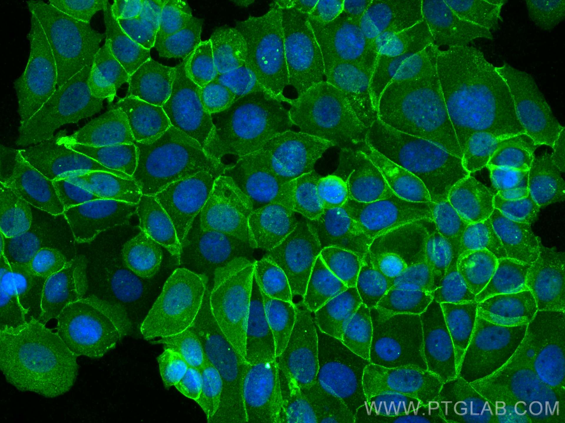 Immunofluorescence (IF) / fluorescent staining of MCF-7 cells using Gamma Catenin Polyclonal antibody (27872-1-AP)