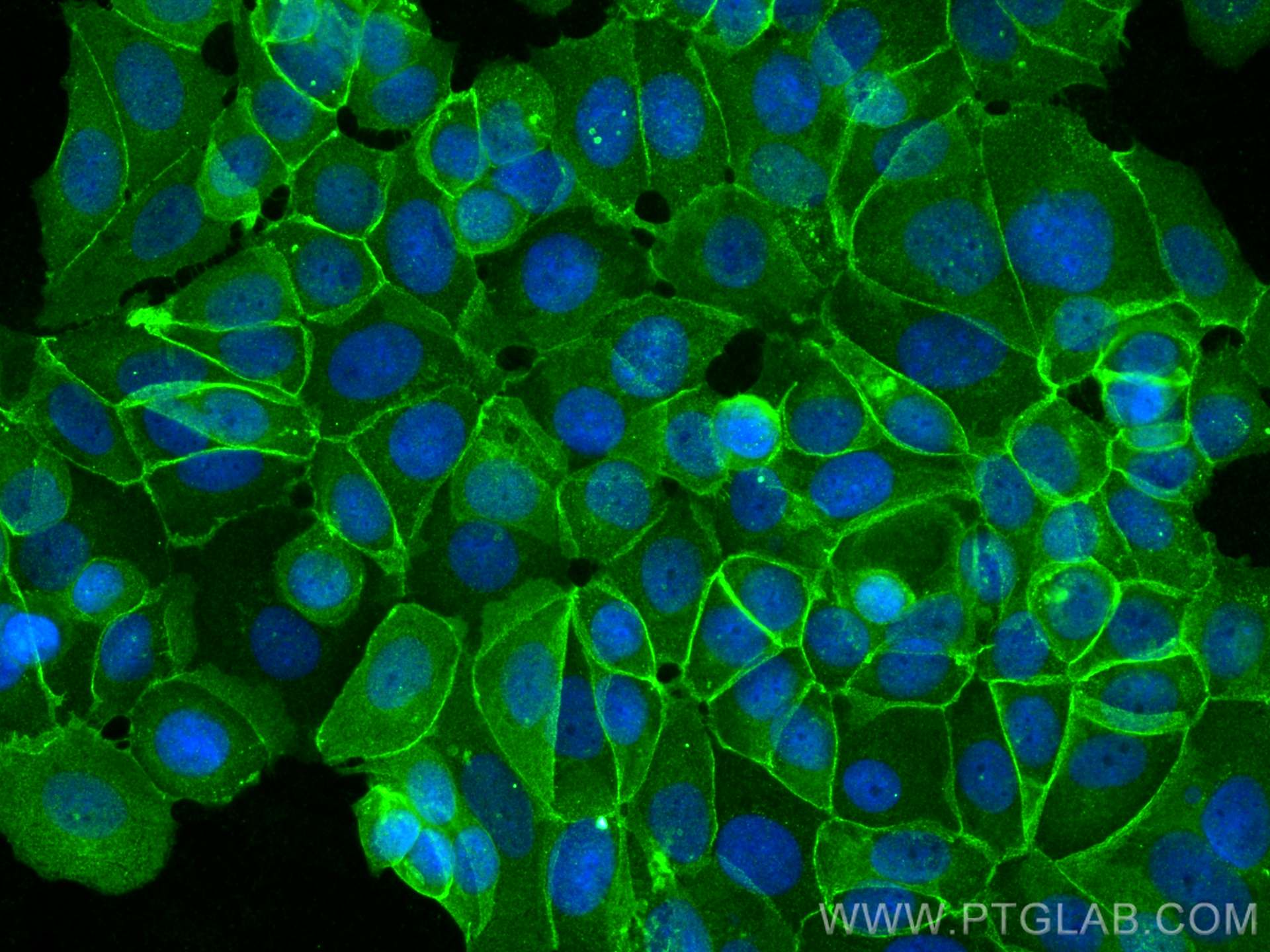 IF Staining of MCF-7 using 27872-1-AP