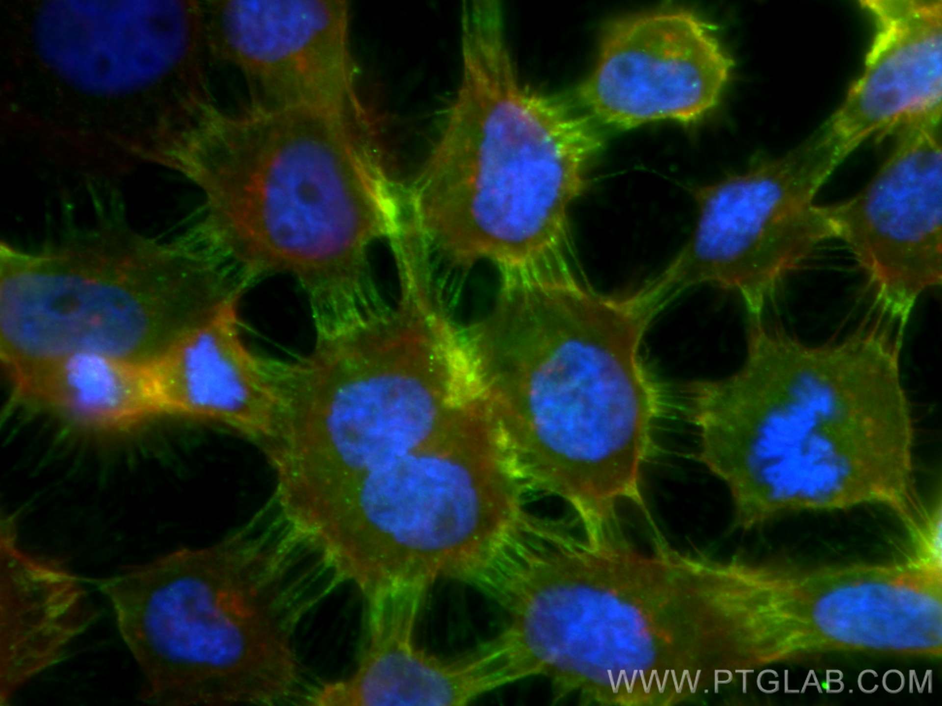 Immunofluorescence (IF) / fluorescent staining of A431 cells using Gamma Catenin Polyclonal antibody (27872-1-AP)
