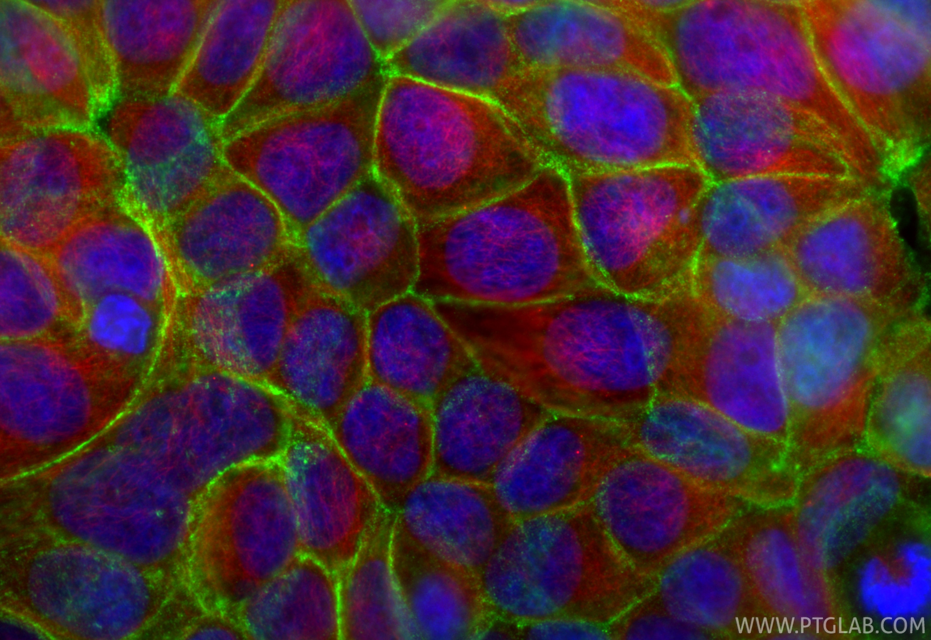 Immunofluorescence (IF) / fluorescent staining of MCF-7 cells using Gamma Catenin Polyclonal antibody (27872-1-AP)