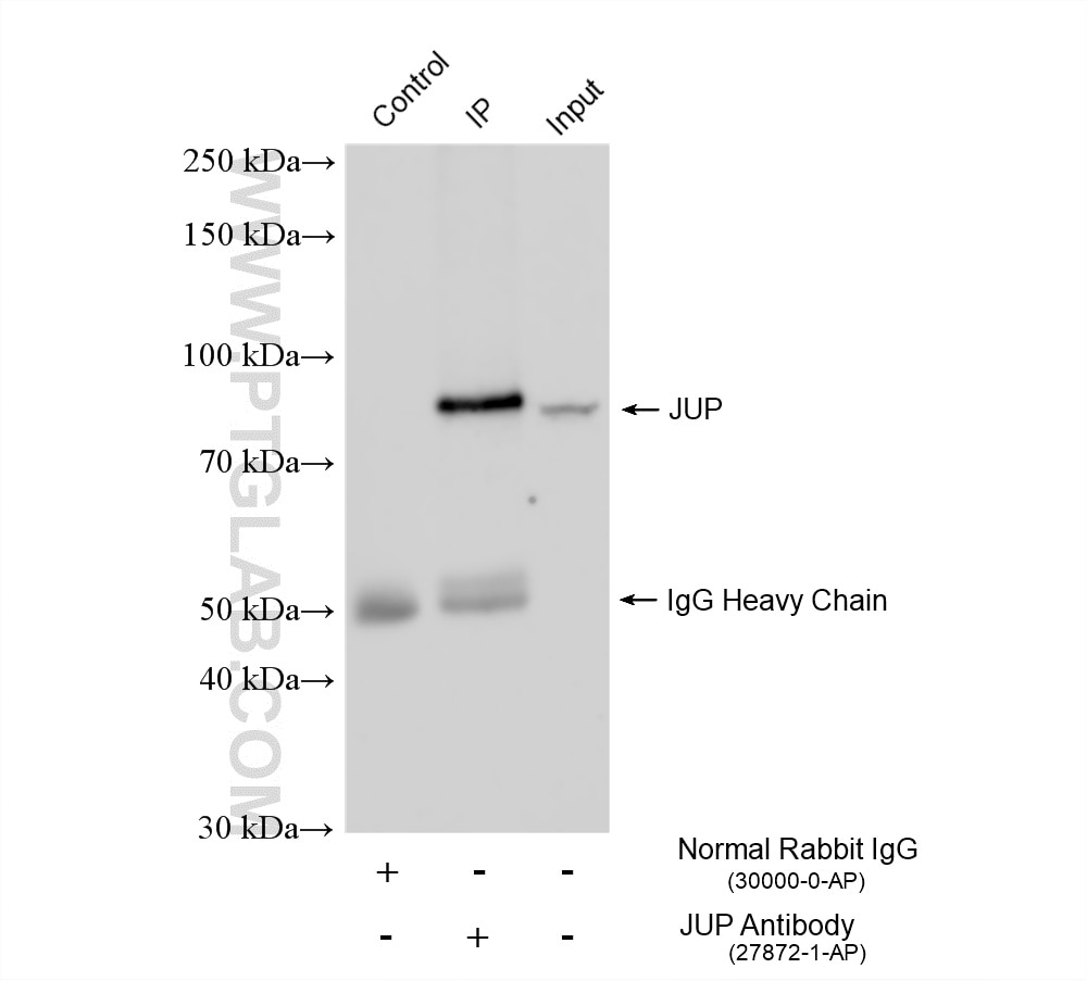 Immunoprecipitation (IP) experiment of mouse heart tissue using Gamma Catenin Polyclonal antibody (27872-1-AP)