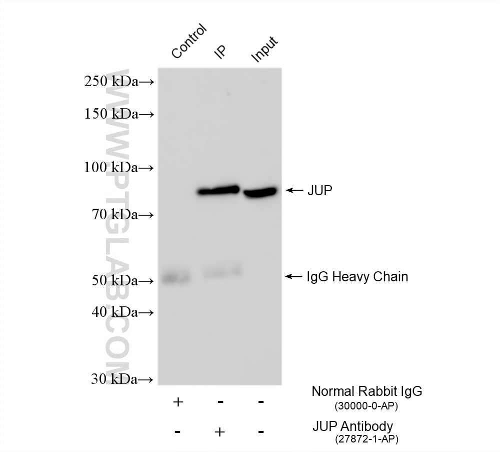 Immunoprecipitation (IP) experiment of HT-29 cells using Gamma Catenin Polyclonal antibody (27872-1-AP)
