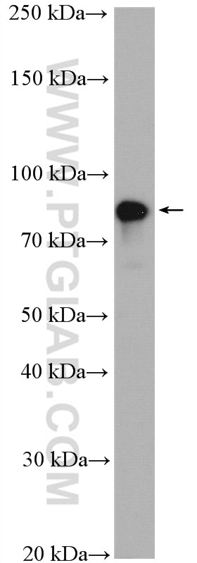 Western Blot (WB) analysis of HUVEC cells using Gamma Catenin Polyclonal antibody (27872-1-AP)