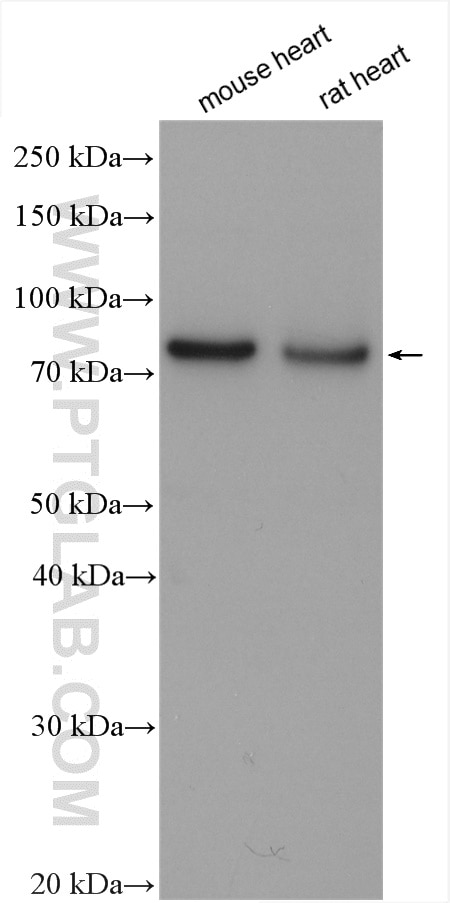 Western Blot (WB) analysis of various lysates using Gamma Catenin Polyclonal antibody (27872-1-AP)