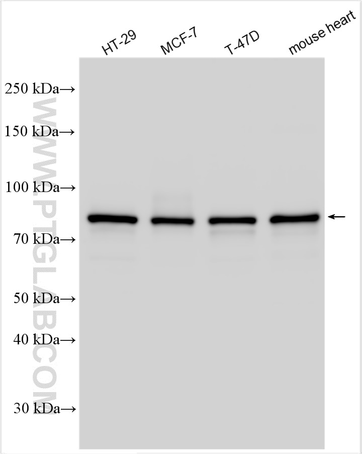 Western Blot (WB) analysis of various lysates using Gamma Catenin Polyclonal antibody (27872-1-AP)