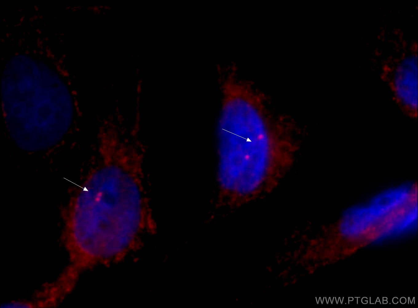 Gamma Tubulin