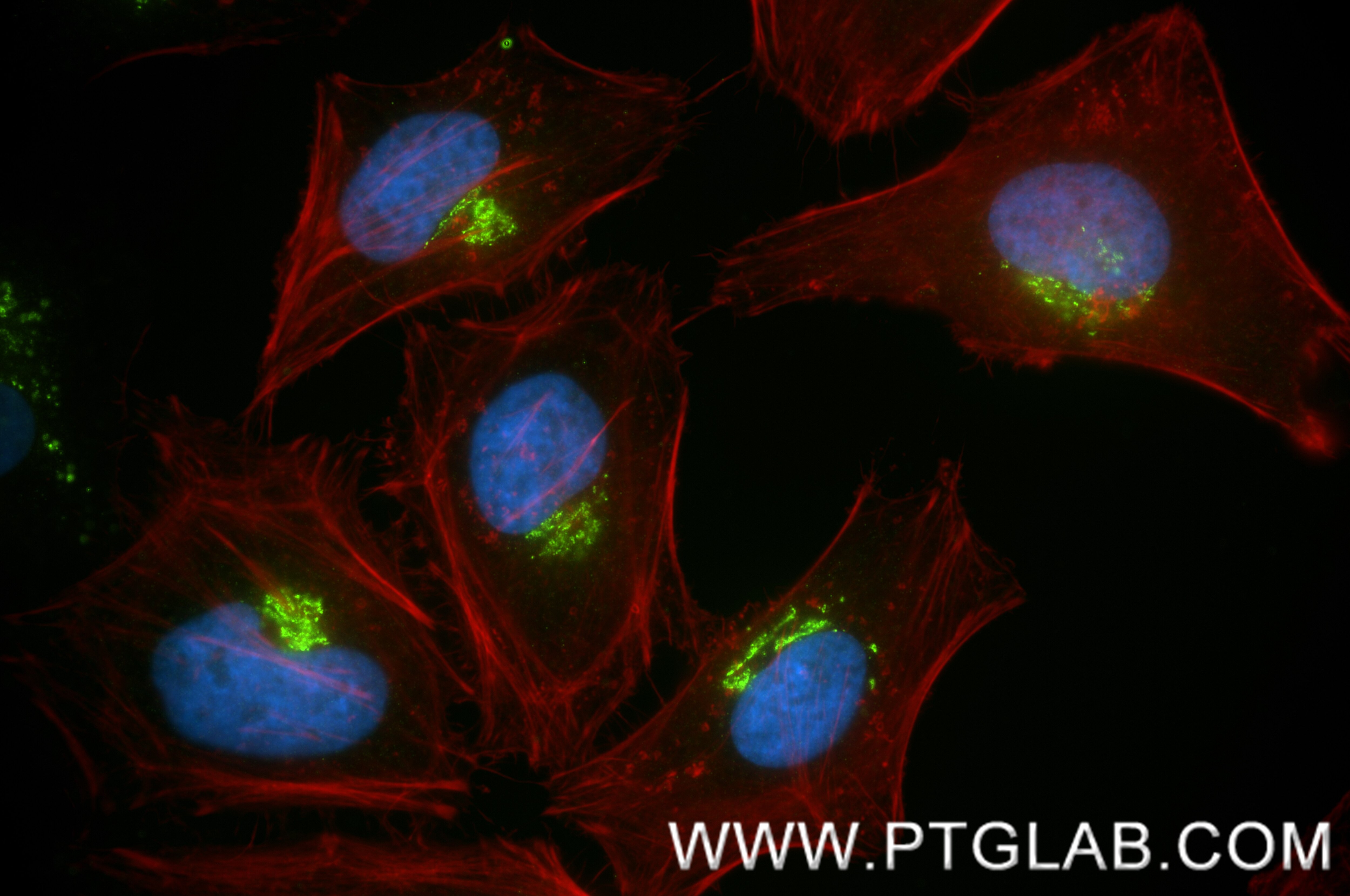 Immunofluorescence (IF) / fluorescent staining of HeLa cells using golgin 97 Recombinant monoclonal antibody (83009-4-RR)