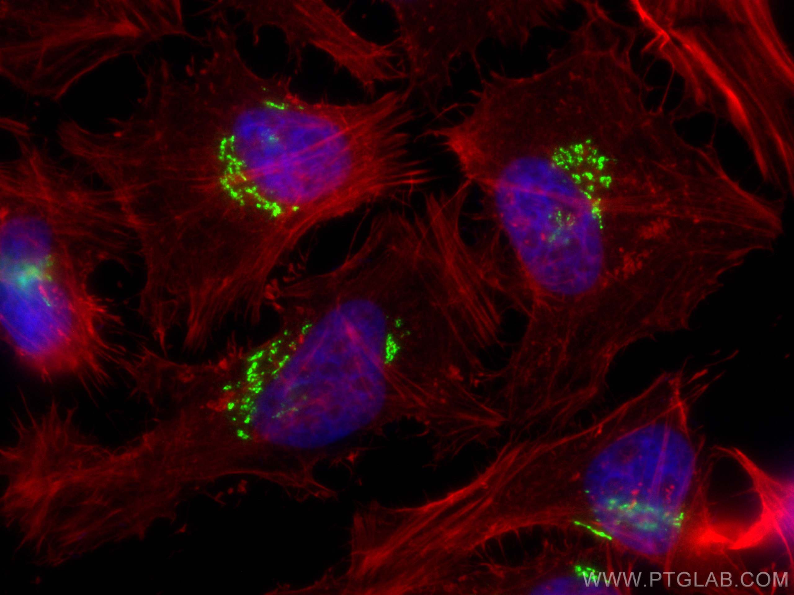 Immunofluorescence (IF) / fluorescent staining of HeLa cells using CoraLite® Plus 488-conjugated golgin 97 Polyclonal (CL488-12640)