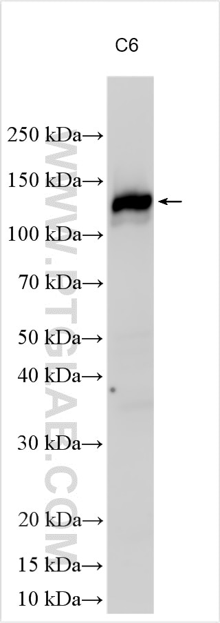 Western Blot (WB) analysis of various lysates using gp130/IL6ST Polyclonal antibody (32186-1-AP)