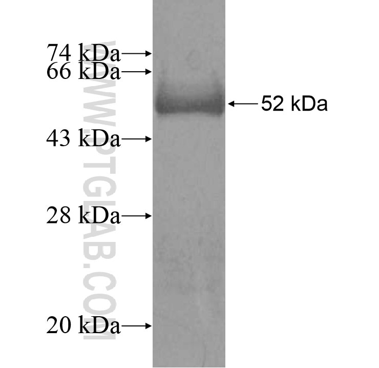 growth-hormone fusion protein Ag13733 SDS-PAGE growth-hormone fusion protein Ag13733 SDS-PAGE