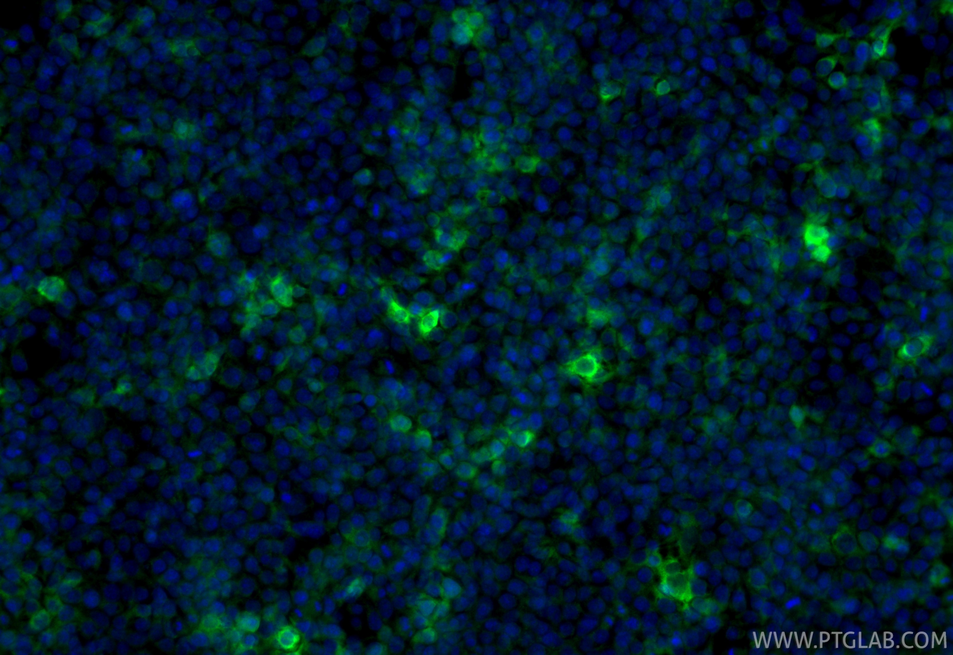 IF Staining of Transfected HEK-293 using 10000-0-AP Immunofluorescence (IF) / fluorescent staining of Transfected HEK-293 cells using GST Tag Polyclonal antibody (10000-0-AP)