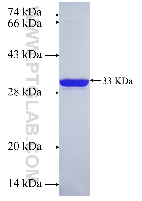 hCG_17324 fusion protein Ag38876 SDS-PAGE hCG_17324 fusion protein Ag38876 SDS-PAGE