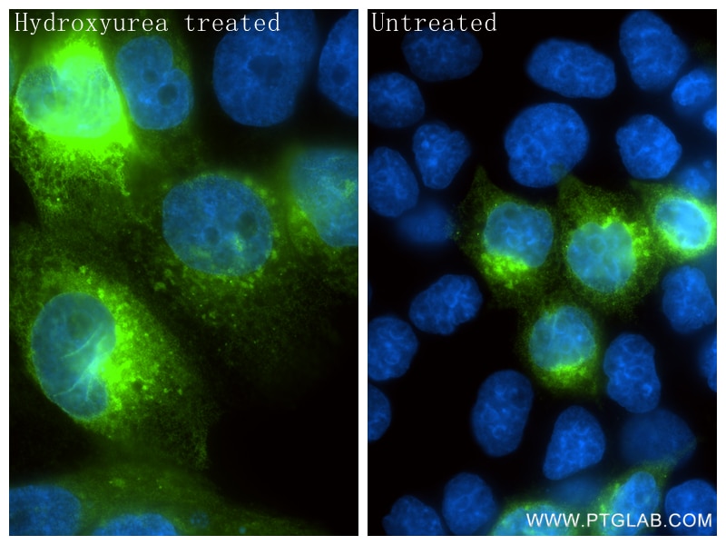 Immunofluorescence (IF) / fluorescent staining of JAR cells using hCG Alpha Recombinant monoclonal antibody (85800-9-RR)