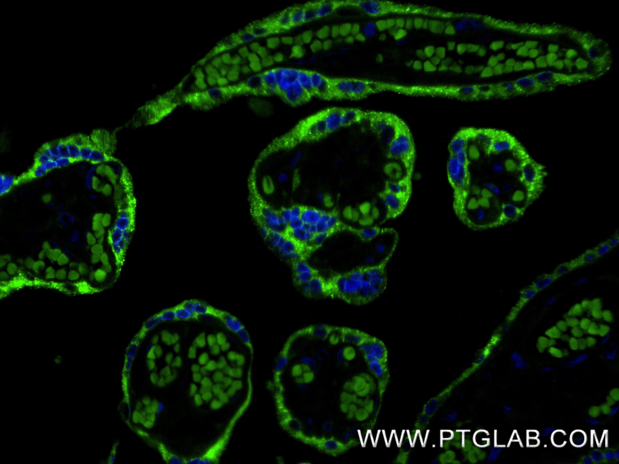 Immunofluorescence (IF) / fluorescent staining of human placenta tissue using hCG Alpha Recombinant monoclonal antibody (85800-9-RR)