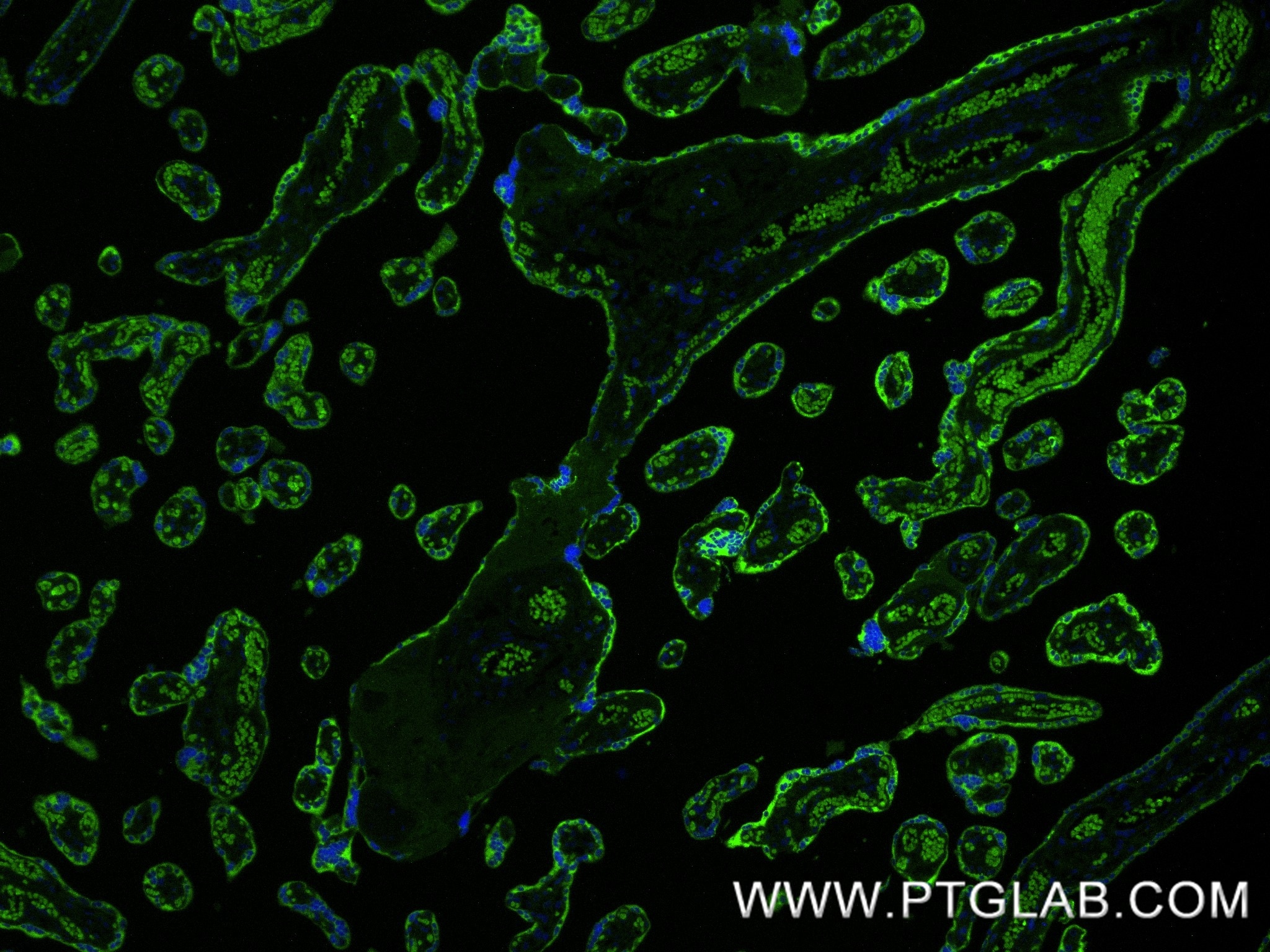 Immunofluorescence (IF) / fluorescent staining of human placenta tissue using hCG Alpha Recombinant monoclonal antibody (85800-9-RR)