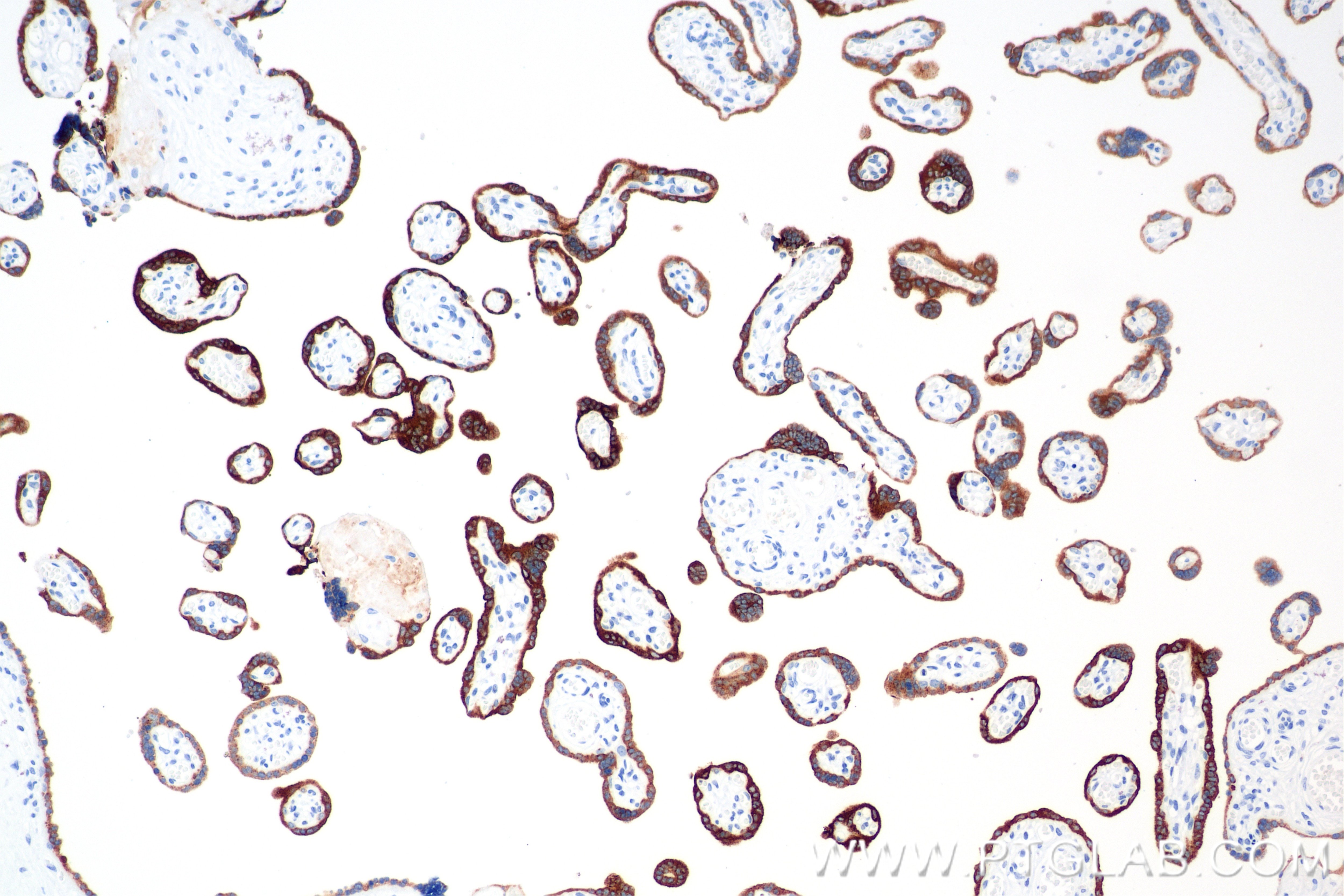 Immunohistochemistry (IHC) staining of human placenta tissue using hCG Alpha Recombinant monoclonal antibody (85800-9-RR)