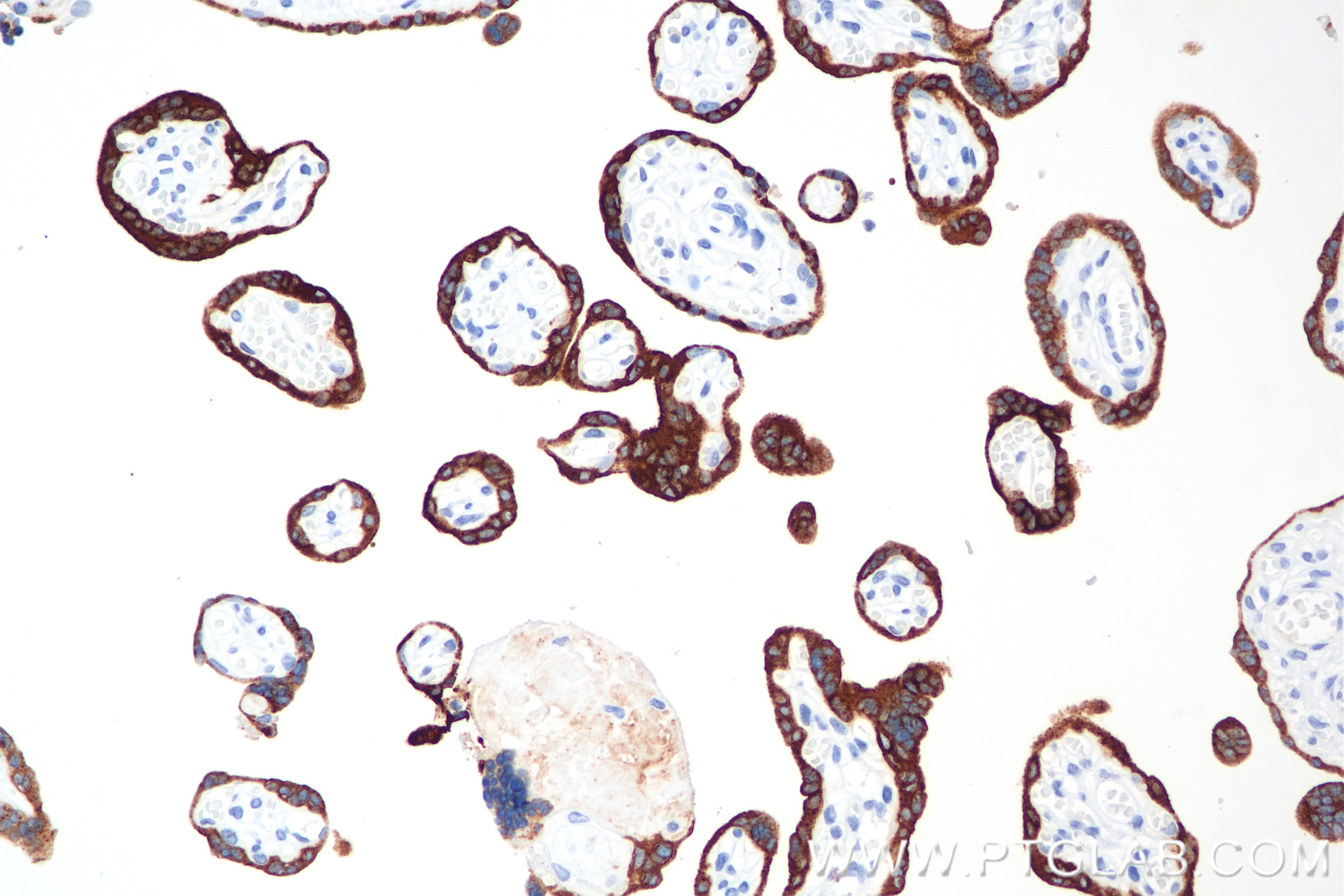 Immunohistochemistry (IHC) staining of human placenta tissue using hCG Alpha Recombinant monoclonal antibody (85800-9-RR)