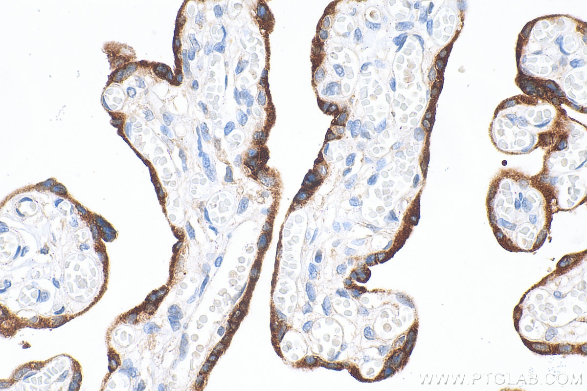 IHC staining of human placenta using 33278-1-AP (same clone as 33278-1-PBS) Immunohistochemistry (IHC) staining of human placenta tissue using hCG Beta Polyclonal antibody (33278-1-AP)