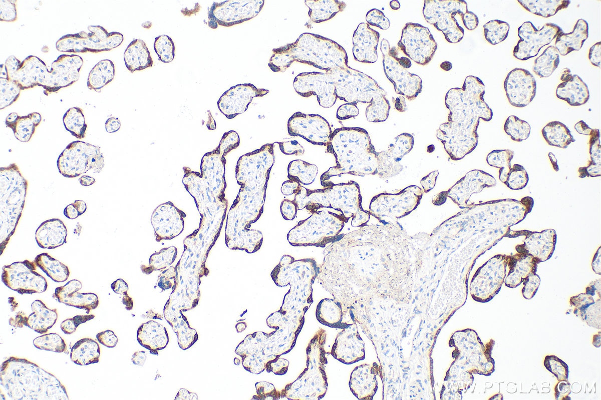 IHC staining of human placenta using 33278-1-AP (same clone as 33278-1-PBS) Immunohistochemistry (IHC) staining of human placenta tissue using hCG Beta Polyclonal antibody (33278-1-AP)