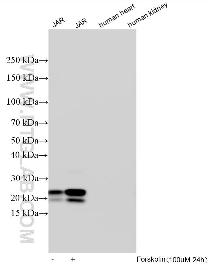 WB analysis using 33278-1-AP (same clone as 33278-1-PBS) Western Blot (WB) analysis of various lysates using hCG Beta Polyclonal antibody (33278-1-AP)