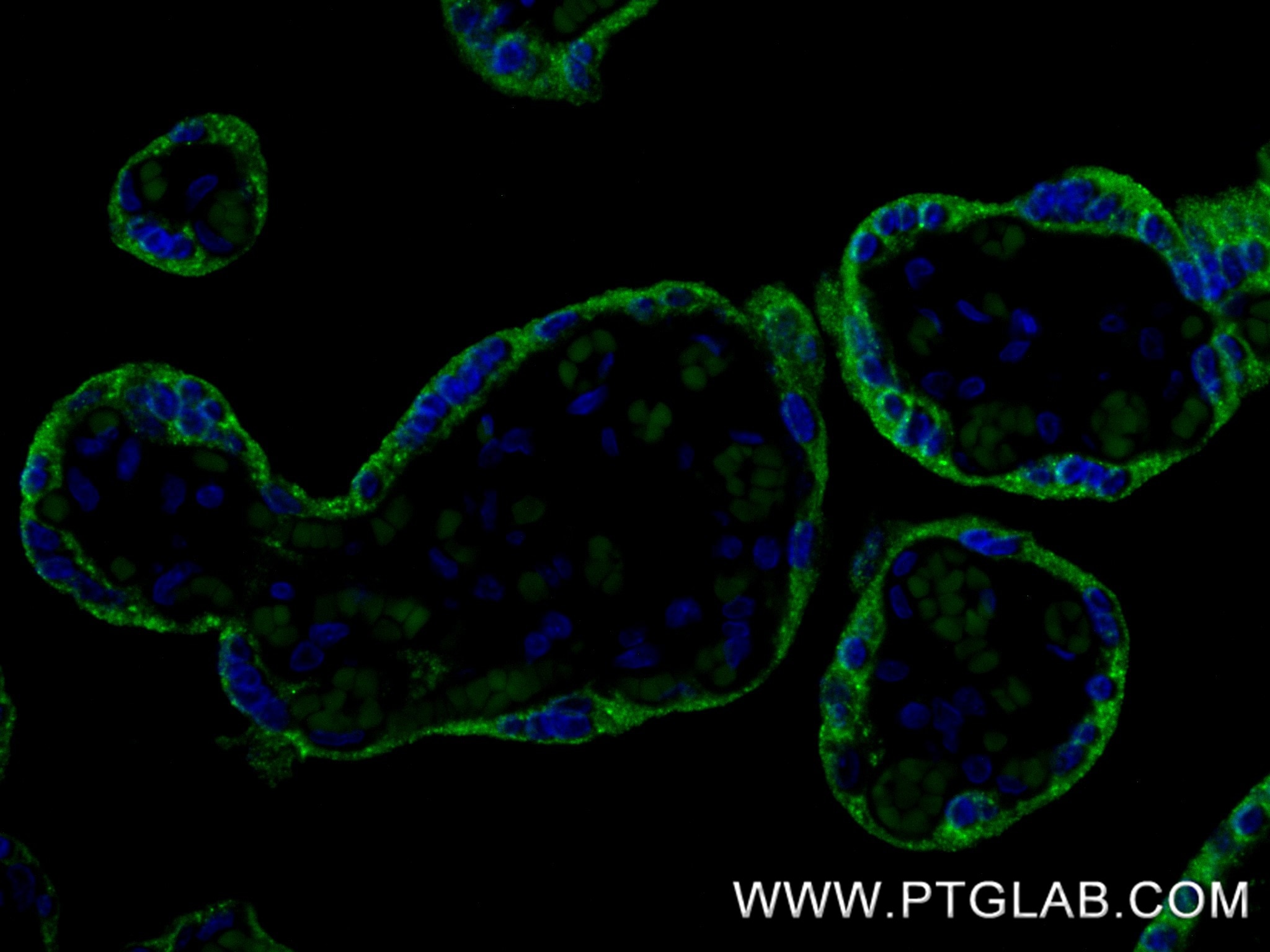 Immunofluorescence (IF) / fluorescent staining of human placenta tissue using hCG Beta Recombinant monoclonal antibody (85800-7-RR)