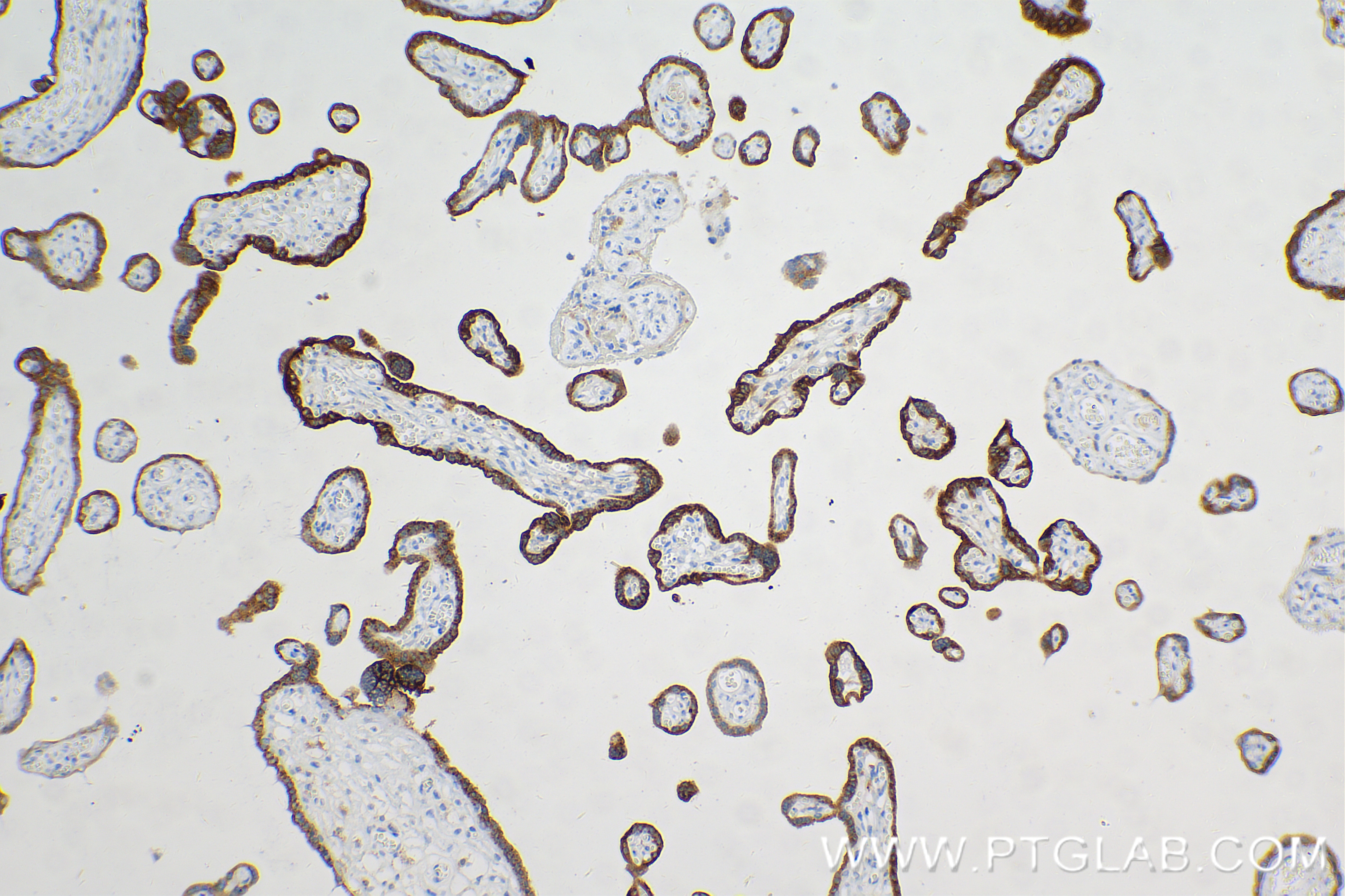 Immunohistochemistry (IHC) staining of human placenta tissue using hCG Beta Recombinant antibody (85800-7-RR)