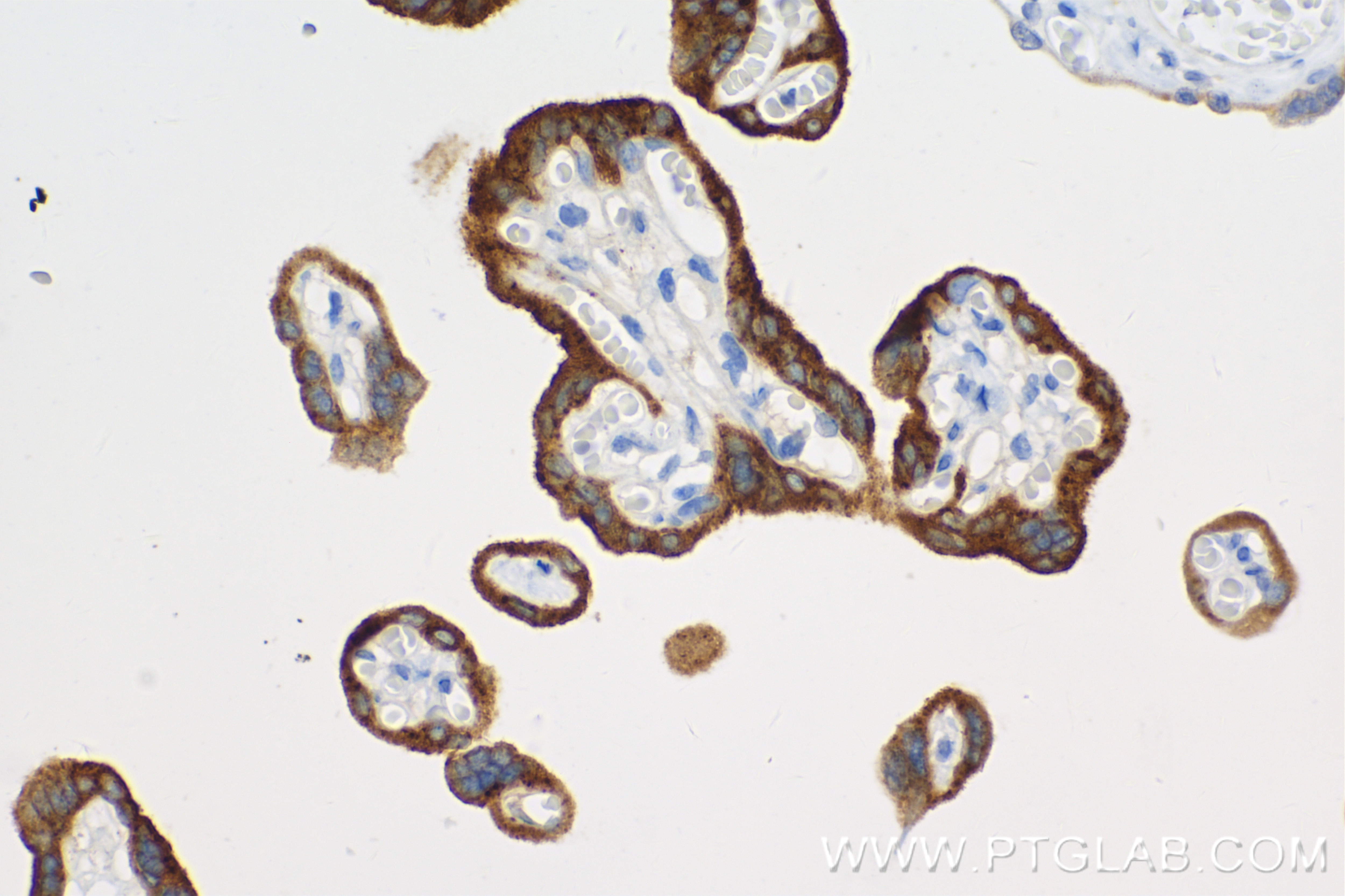 hCG Beta