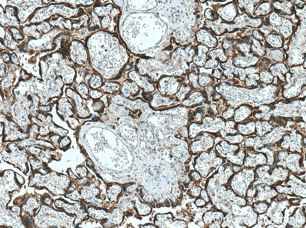 Immunohistochemistry (IHC) staining of human placenta tissue using hCG Alpha Polyclonal antibody (25014-1-AP)