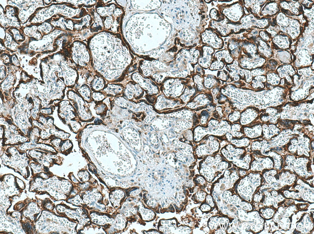 IHC staining of human placenta using 25014-1-AP