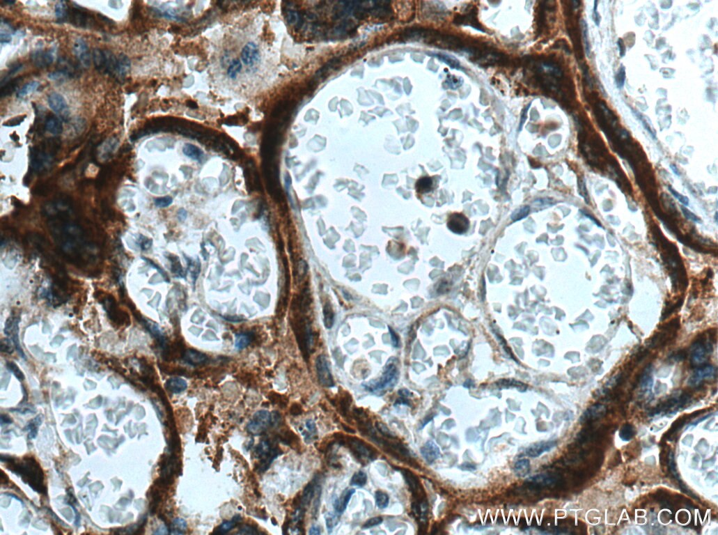 Immunohistochemistry (IHC) staining of human placenta tissue using hCG Alpha Polyclonal antibody (25014-1-AP)