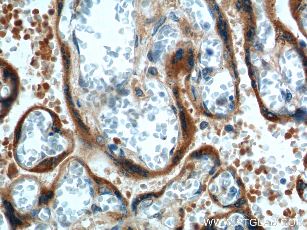 hCG Alpha Polyclonal antibody