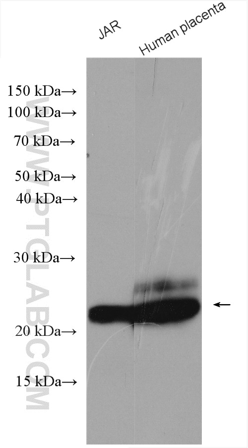 Western Blot (WB) analysis of various lysates using hCG Alpha Polyclonal antibody (25014-1-AP)