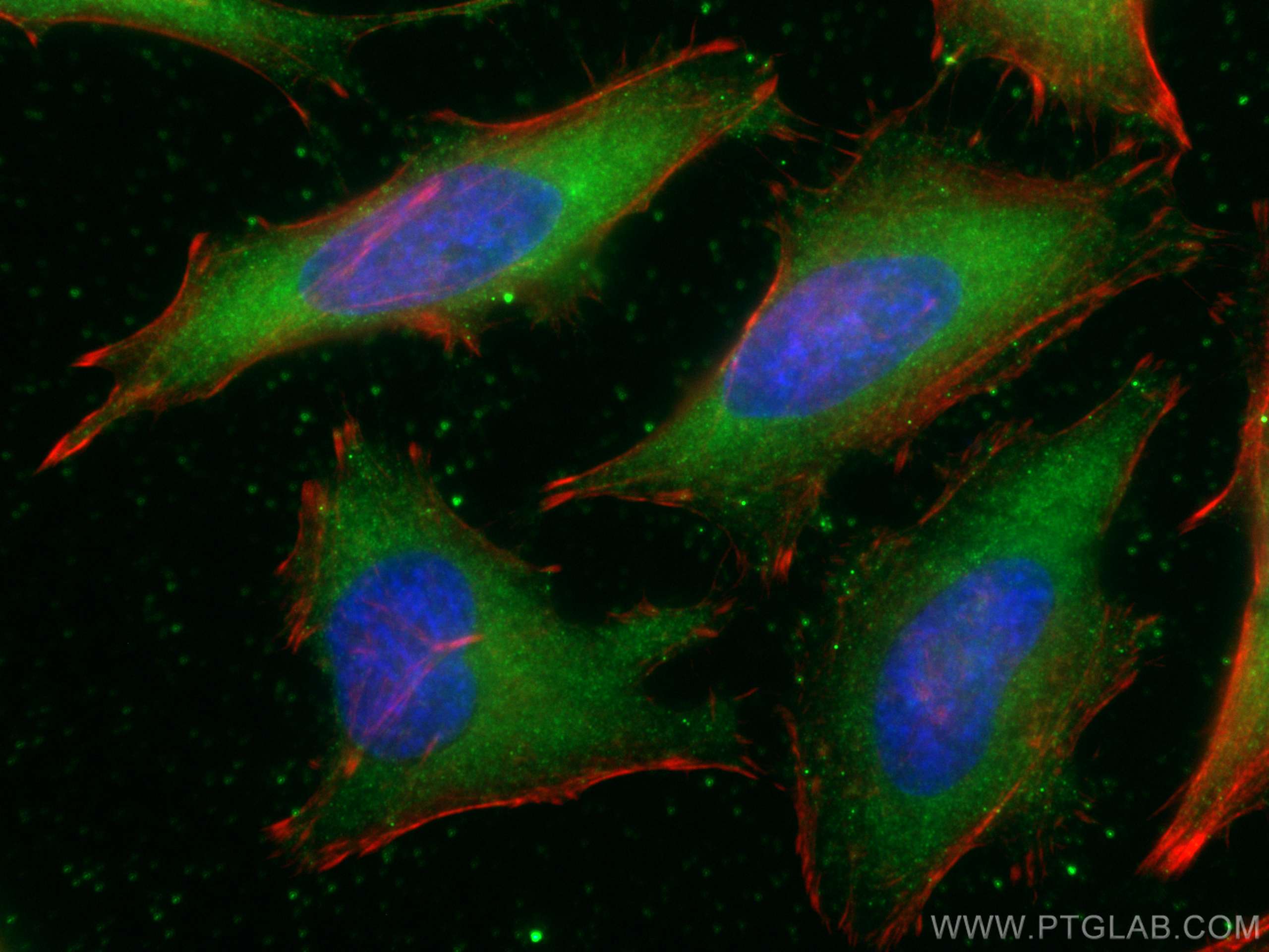 Immunofluorescence (IF) / fluorescent staining of HeLa cells using hIST1 Monoclonal antibody (66989-1-Ig)